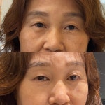리뉴얼성형외과의원 위치 · 진료시간 · 후기 확인하기