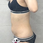 더라인성형외과의원 위치 · 진료시간 · 후기 확인하기