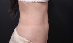 베리굿성형외과의원 위치 · 진료시간 · 후기 확인하기