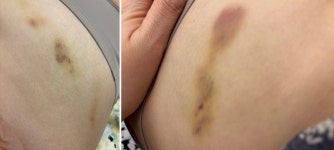 밴스의원 위치 · 진료시간 · 후기 확인하기