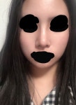 서울아이성형외과의원 위치 · 진료시간 · 후기 확인하기