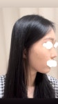 서울아이성형외과의원 위치 · 진료시간 · 후기 확인하기