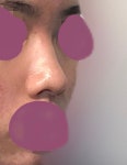 서울아이성형외과의원 위치 · 진료시간 · 후기 확인하기 | 굿닥