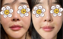 재시아성형외과의원 위치 · 진료시간 · 후기 확인하기 | 굿닥