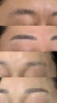 서진성형외과의원 위치 · 진료시간 · 후기 확인하기