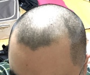 빅터앤롤프 입점 기념 이벤트 | 무신사