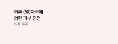 이엘티코스메틱(ELTCOSMETICS) ELT 트리플 캡슐 세럼 30ml - 후기 | 무신사