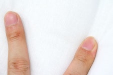 KODAWARI ANMINKAN: 2개 세트 이탈리아제 안나브르스리프메디칼베개(전용 피로케이스, 베개 1개에 대해 1장 부속) 에코 옷감 100 인증 45×75... 