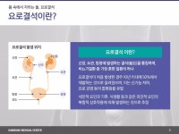 비뇨기질환 10 요로결석의 증상과 치료 | PDF 비뇨기질환 10 요로결석의 증상과 치료