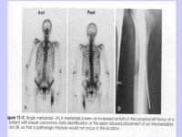 3-october-49renal-bone.pps
