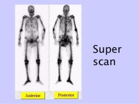 3-october-49renal-bone.pps