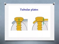 Basic implant ortho | PPTX Basic implant ortho