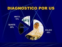 Ca De Tiroides slideshare