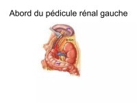 Cancer Du rein | PPT Cancer Du rein