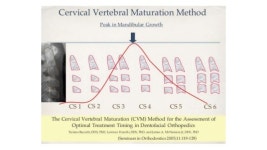 Cvm slideshare