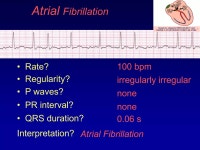 Ecg final the best | PPTX Ecg final the best