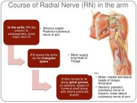 Radial nerve palsy slideshare