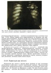 Radiologiya, учебник МЕДИЦИНСКАЯ РАДИОЛОГИЯ slideshare