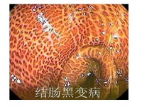 腸內小世界 健康大關鍵~ | PPT 腸內小世界 健康大關鍵~