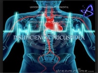 insuficiencia tricuspidea