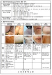 소야초등학교 :: 가정통신문 :: 원숭이두창 예방 및 행동수칙 안내