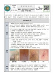 엠폭스 위기경보수준 단계 상향 (관심->주의) 알림 :: 가정통신문 :: 인천사리울중학교 인천사리울중학교 :: 가정통신문 :: 엠폭스 위기경보수준... 
