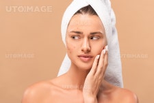 유토이미지 | nude girl in towel touching face with acne and looking away isolated on beige