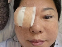 양희은, '각막이식 수술' 후 근황...