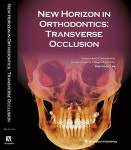 New Horizon in Orthodontics: Transverse Occlusion | Kee-Joon Lee | 명문출판사 - 예스24