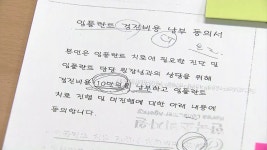 [경제]건보 임플란트 시술 불만↑...병원 선택 신중해야 | YTN 건보 임플란트 시술 불만↑...병원 선택 신중해야