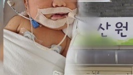 [사회]자연주의 출산 조산원 믿었는데...생후 2개월 딸 뇌 손상 | YTN 자연주의 출산 조산원 믿었는데...생후 2개월 딸 뇌 손상