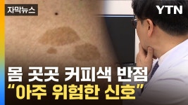 [자막뉴스] 방치했다간 생명까지 위협...커피색 반점 희귀병 징후 | YTN [자막뉴스] 방치했다간 생명까지 위협...커피색 반점 희귀병 징후