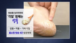 홈쇼핑 속 각질 알고 보니 밥풀 | YTN [뉴스타트]방송 위해 일주일 모았어요...홈쇼핑 속 각질 알고 보니 밥풀