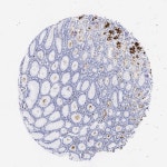 Tissue expression of FUT4 - Staining in stomach - The Human Protein Atlas