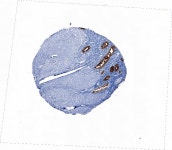 Tissue expression of FUT4 - Staining in endometrium - The Human Protein Atlas