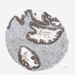 Tissue expression of KTN1 - Staining in prostate - The Human Protein Atlas