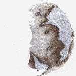 Tissue expression of FZD6 - Staining in vagina - The Human Protein Atlas