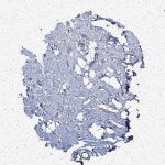 Tissue expression of GUCY1B1 - Staining in soft tissue - The Human Protein Atlas