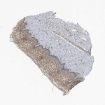 Tissue expression of CDV3 - Staining in vagina - The Human Protein Atlas