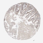 Tissue expression of AK9 - Staining in duodenum - The Human Protein Atlas