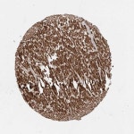 Tissue expression of AIM2 - Staining in heart muscle - The Human Protein Atlas
