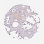 Tissue expression of AAR2 - Staining in prostate - The Human Protein Atlas