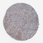 Tissue expression of MORN3 - Staining in adrenal gland - The Human Protein Atlas