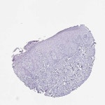 Tissue expression of AMY1B - Staining in skin - The Human Protein Atlas