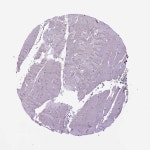 비즈비팝 | Tissue expression of CDH1 - Staining in skeletal muscle - The Human Protein Atlas