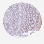 Tissue expression of HRG - Staining in stomach - The Human Protein Atlas