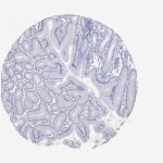 Tissue expression of CD79A - Staining in stomach - The Human Protein Atlas