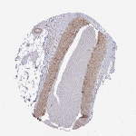 Tissue expression of UBE2S - Staining in soft tissue - The Human Protein Atlas