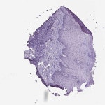 Tissue expression of PROB1 - Staining in vagina - The Human Protein Atlas