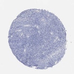 Tissue expression of VAT1L - Staining in ovary - The Human Protein Atlas